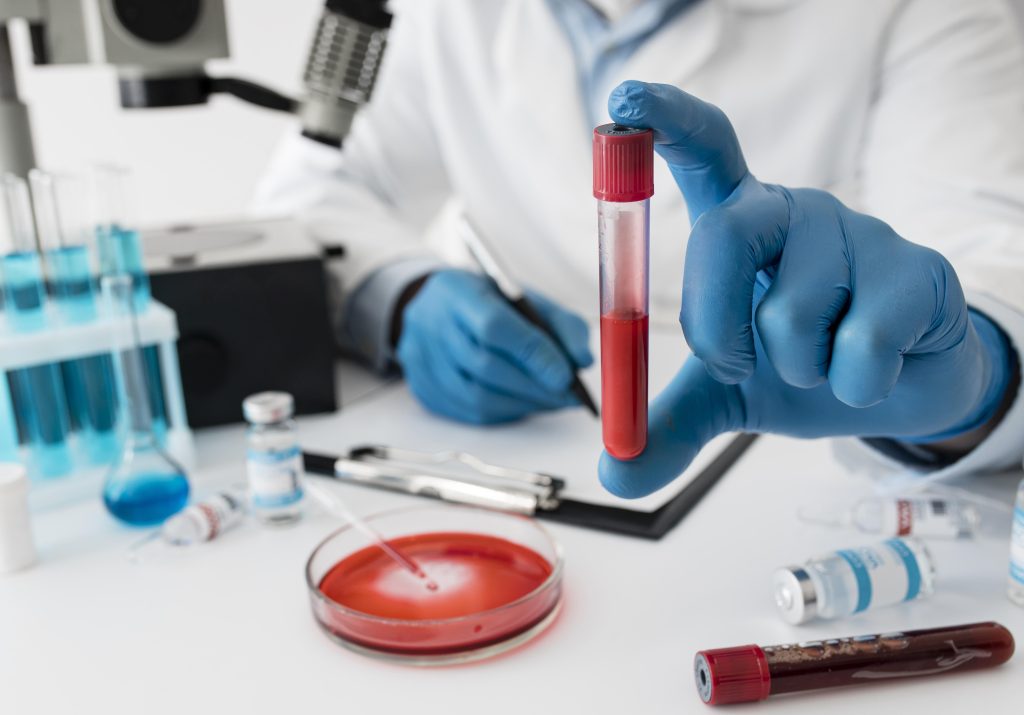 Profissional de saúde segurando tubo de sangue usado para identificar anemia em exames laboratoriais