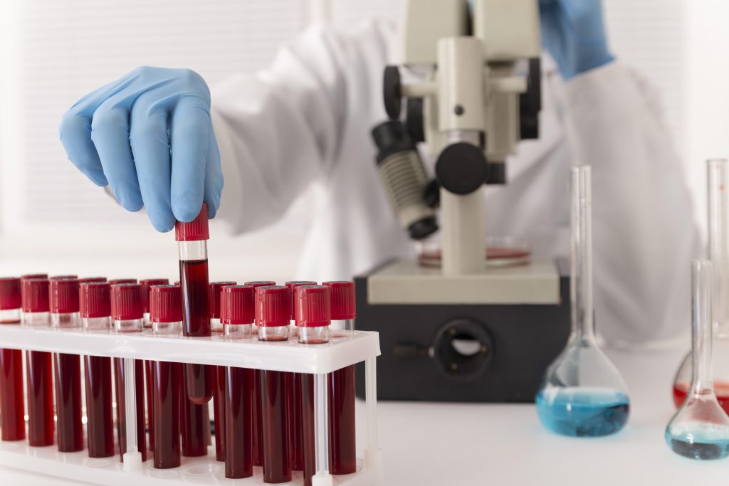 Profissional de saúde analisando tubos de sangue em laboratório para diagnóstico de anemia