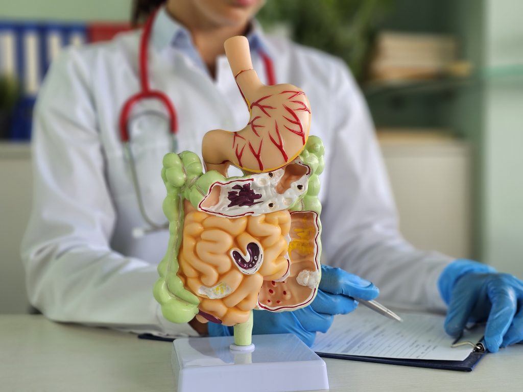 Modelo anatômico do sistema digestivo em consulta médica sobre intestino e emagrecimento saudável